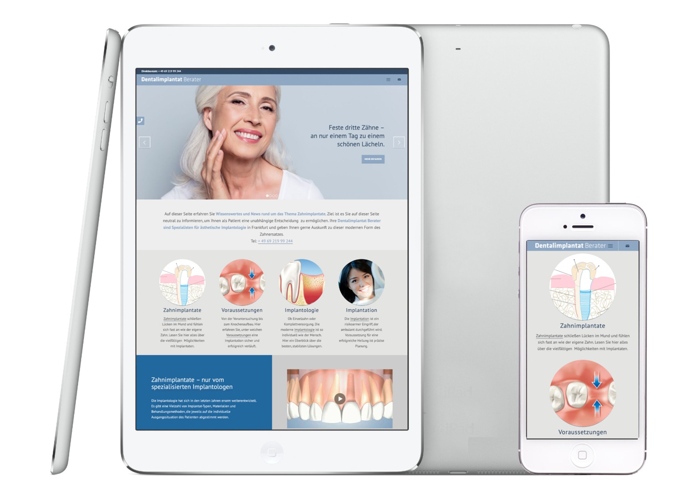 Homepage Entwicklung für Zahnimplantat Berater